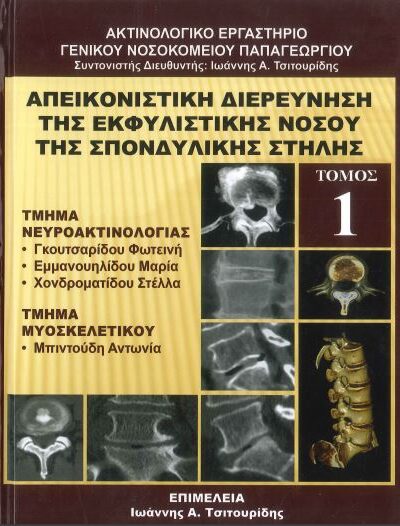 ΑΠΕΙΚΟΝΙΣΤΙΚΗ ΔΙΕΡΕΥΝΗΣΗ ΤΗΣ ΕΚΦΥΛΙΣΤΙΚΗΣ ΝΟΣΟΥ ΤΗΣ ΣΠΟΝΔΥΛΙΚΗΣ ΣΤΗΛΗΣ