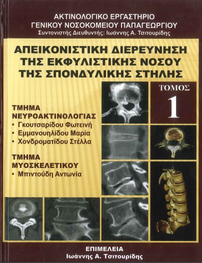 ΑΠΕΙΚΟΝΙΣΤΙΚΗ ΔΙΕΡΕΥΝΗΣΗ ΤΗΣ ΕΚΦΥΛΙΣΤΙΚΗΣ ΝΟΣΟΥ ΤΗΣ ΣΠΟΝΔΥΛΙΚΗΣ ΣΤΗΛΗΣ